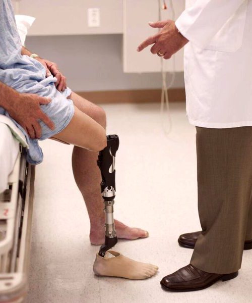Травмованим рекомендують протезуватися в Україні через необхідність постійного технічного обслуговування протезів