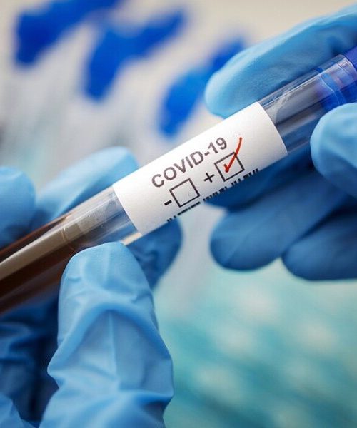 В Україні зафіксували перший випадок зараження новим штамом підвиду коронавірусу