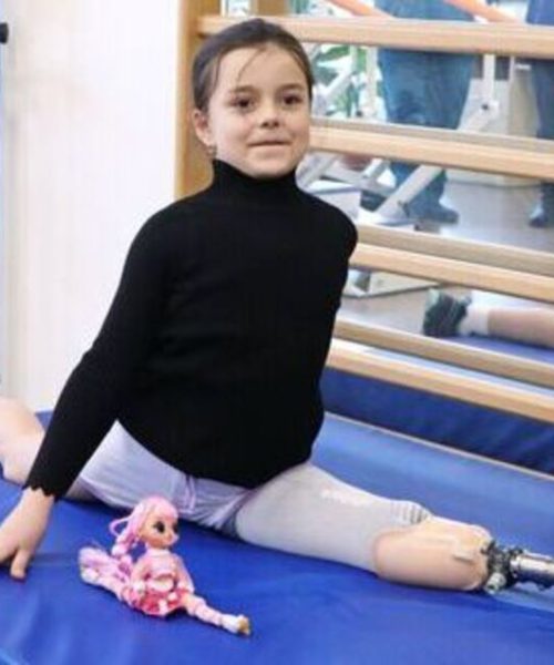 Після протезування маленька одеситка виграла змагання з художньої гімнастики