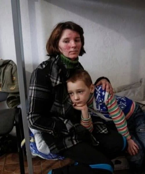 Безкоштовний прихисток переселенцям зможуть надавати українці, які виїхали за кордон